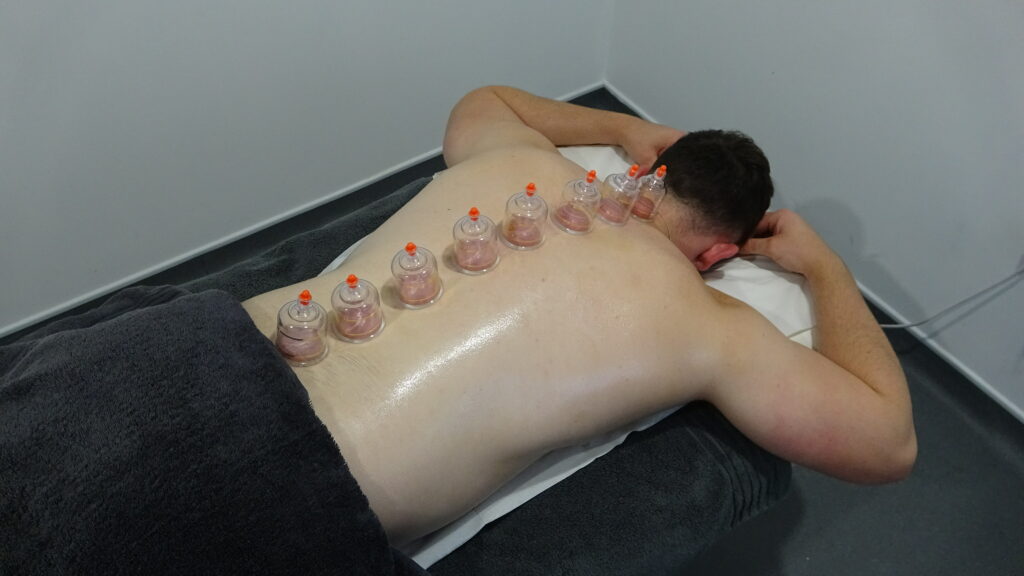 Cupping Cambridge